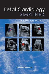 Fetal Cardiology Simplified A Practical Manual
