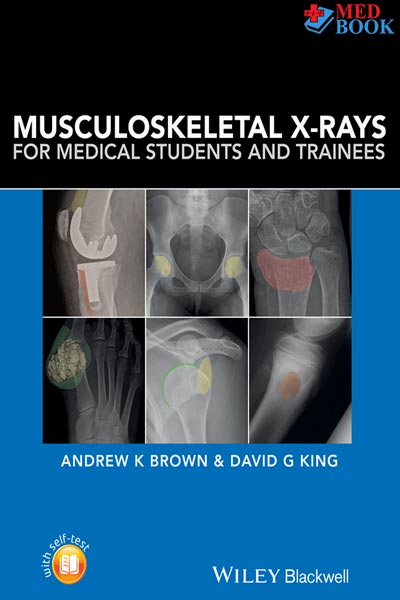 Musculoskeletal X‐rays for Medical Students and Trainees