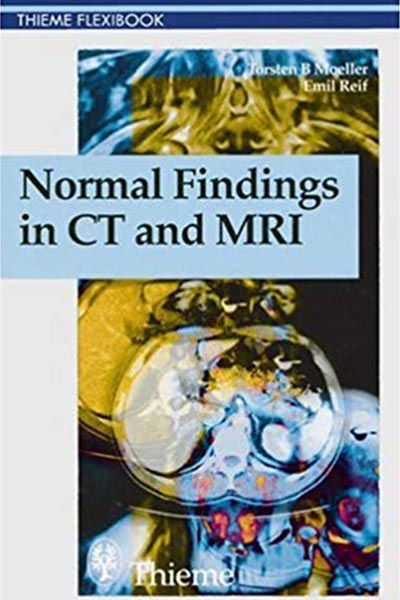 Normal Findings in CT and MRI