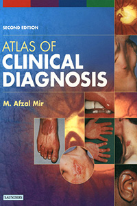 Atlas of Clinical Diagnosis 2nd 2003