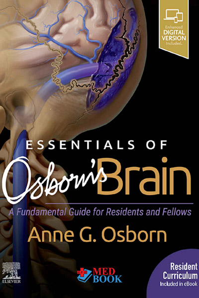 Essentials of Osborns Brain: A Fundamental Guide for Residents and ...