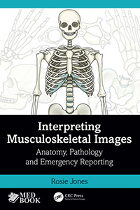 Interpreting-Musculoskeletal-Images-1Ed-2023