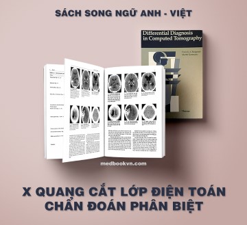 Sach-x-quang-cat-lop-dien-toan-chan-doan-phan-biet